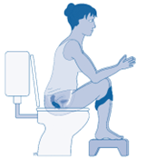 Woman using a foot stool to assist in relieving constipation.